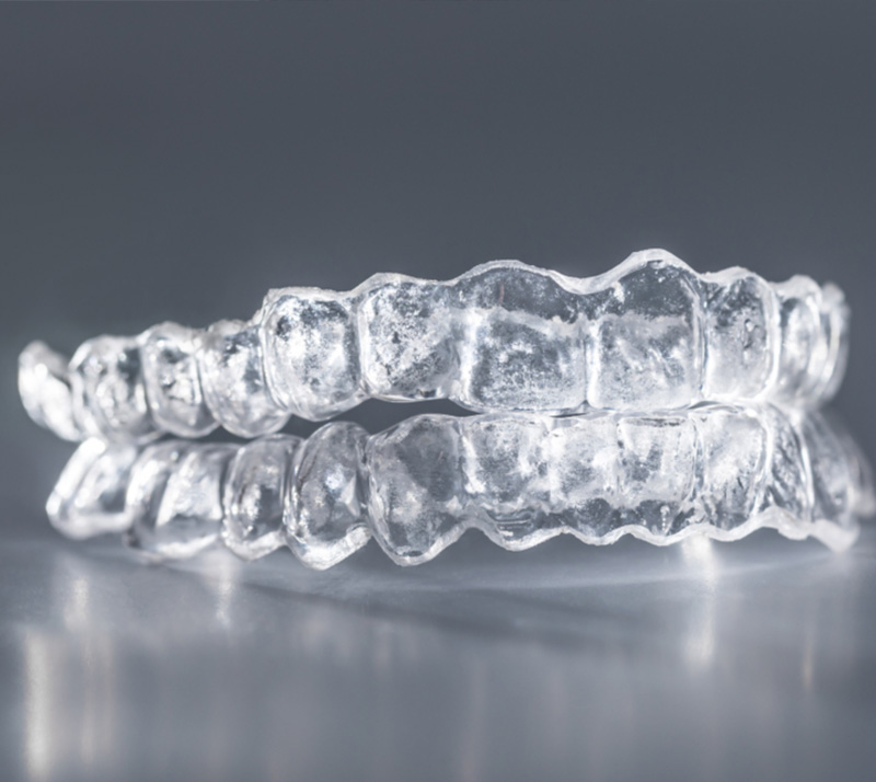 clear aligners in red deer