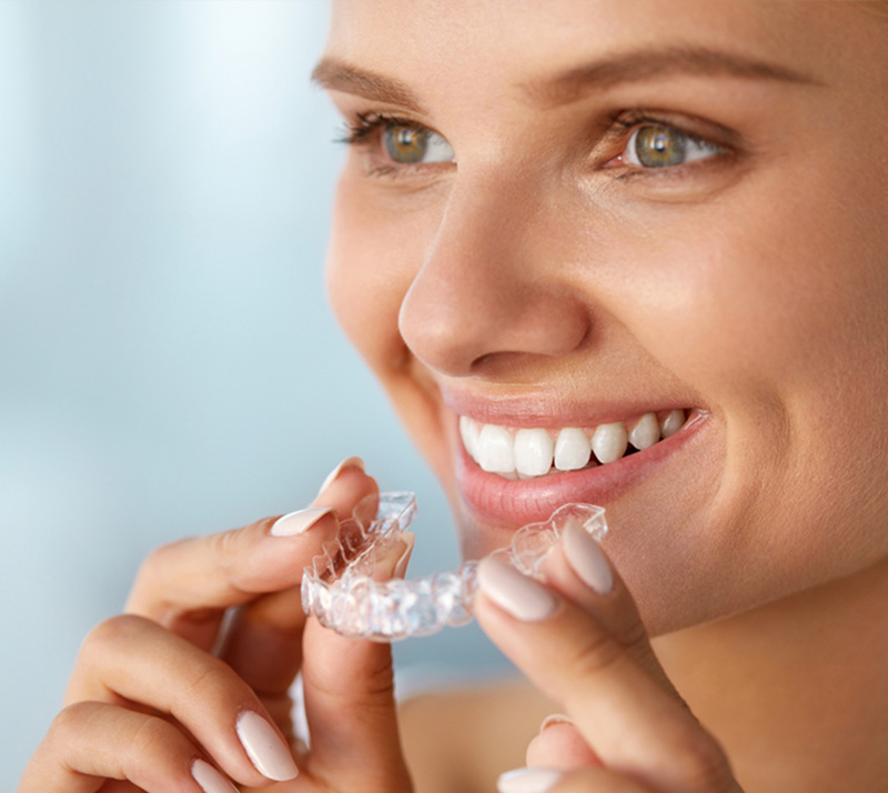 invisalign in red deer