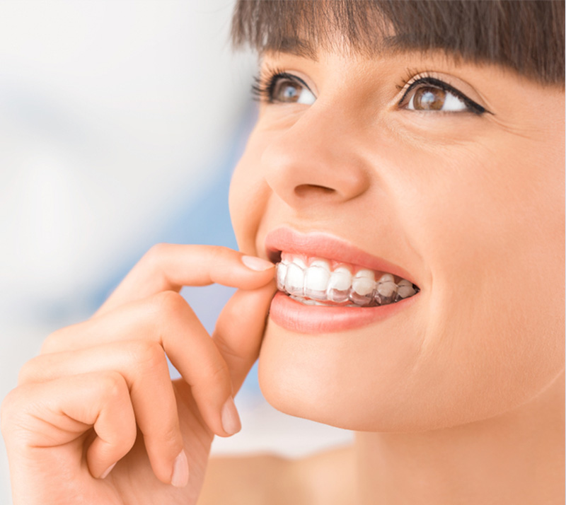 Orthodontics-2 Dr. Peter Servinis