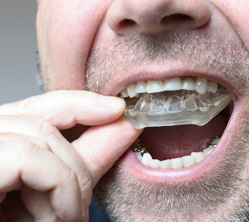 Snoring-Sleep-Apnea-2 Dr. Peter Servinis