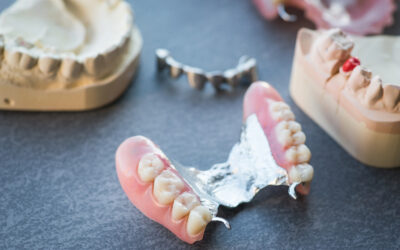 What Are Dentures and Are They Beneficial?